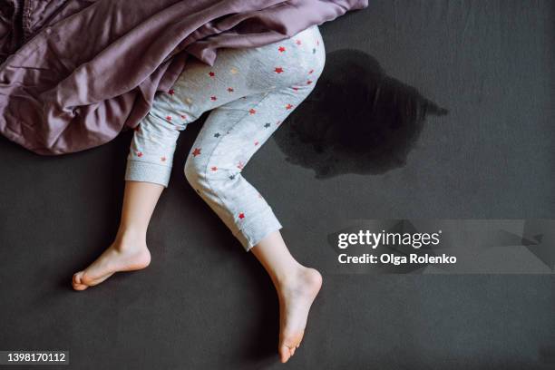 unrecognizable child legs on wet bed. incontinence problem - avergonzamiento fotografías e imágenes de stock