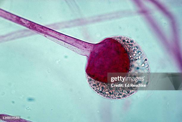 rhizopus, black bread mold, sporangium with spores & sporangiophore, phycomycetes. 100x at 35mm - rhizopus stock pictures, royalty-free photos & images