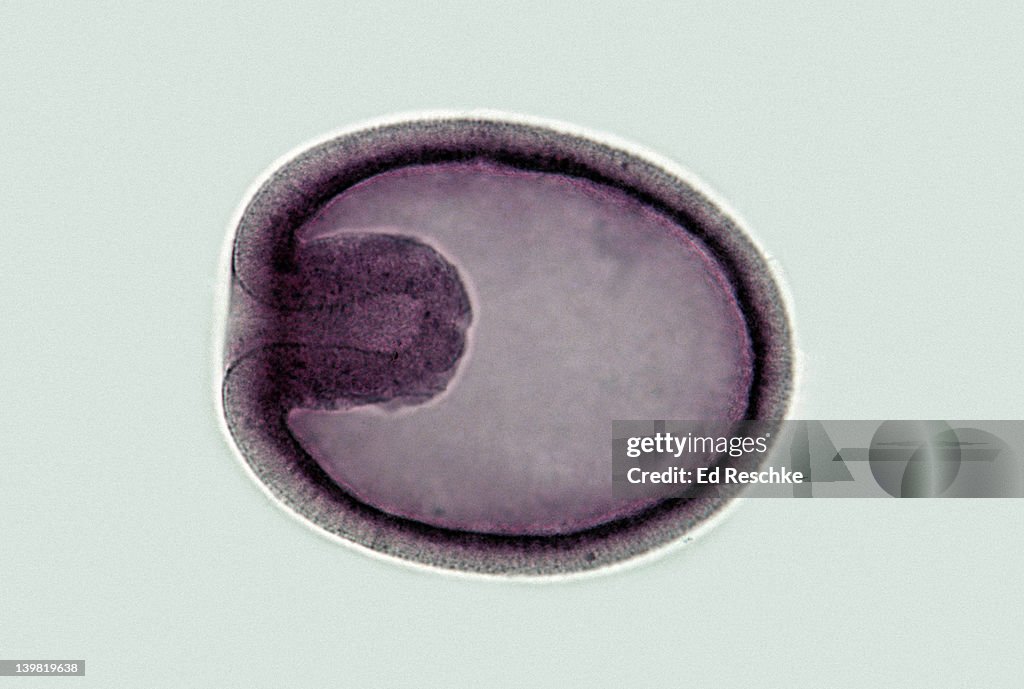 Starfish. Gastrula; early. Shows ectoderm, endoderm, archente ron, blastocoel & blastopore, 100x at 35mm