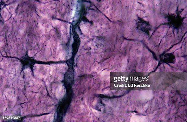 astrocytes; neuroglial cells, 280x at 35mm. shows: processes (perivascular feet) of the astrocytes intimately associated with a brain capillary. possibly helps form the blood-brain barrier to drugs, antibiotics, etc. - astrocyte stock pictures, royalty-free photos & images