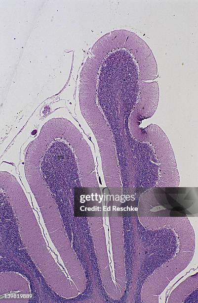 cerebellum; brain, 5x at 35mm. shows: gray matter of the cerebellar cortex, molecular layer, purkinje cell layer, granular layer, white matter, meninges. - hypothalamus stock pictures, royalty-free photos & images