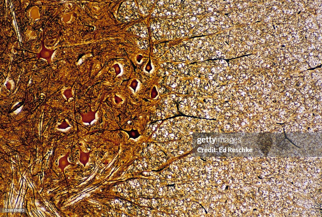 Gray & white matter; spinal cord, 25X at 35mm. Shows: gray matter (neuron cell bodies and unmyelinated nerve fibers), and white matter (myelinated nerve fibers in cross section).