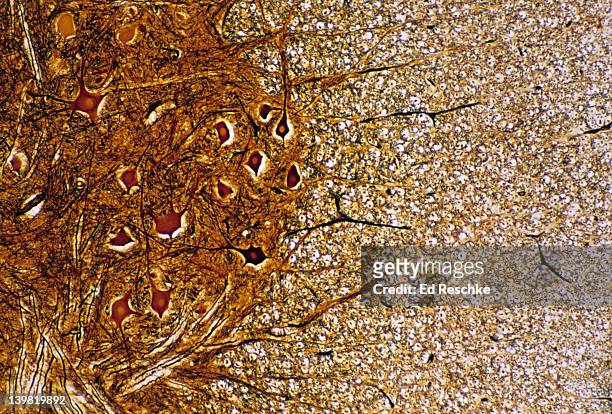 gray & white matter; spinal cord, 25x at 35mm. shows: gray matter (neuron cell bodies and unmyelinated nerve fibers), and white matter (myelinated nerve fibers in cross section). - nucleoid stock pictures, royalty-free photos & images