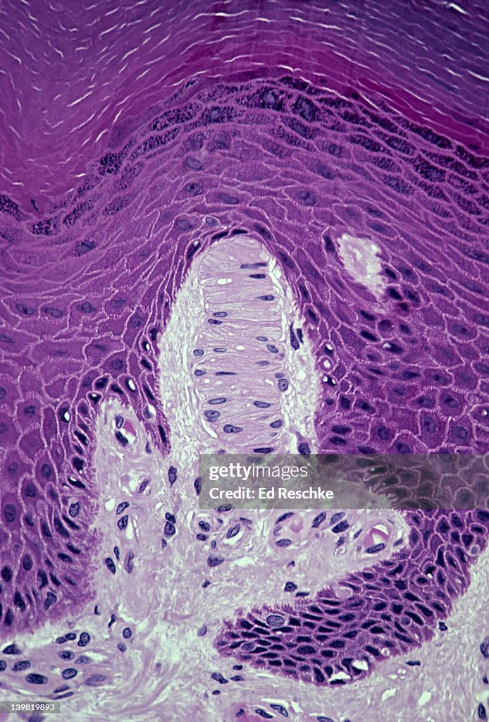 Meissners corpuscle; sensory receptor, skin (palm), 100X at 35mm. This sensory receptor is senitive to touch (tactile receptor). Located in dermis of skin (palm) directly below epidermis. Human.