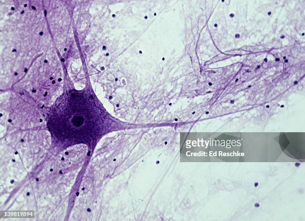 motor neuron; spinal cord, 50x at 35mm. shows: cell body, nucleus, dendrites (numerous processes attached to cell body), axon (single, long, nerve fiber), and neuroglial cells (dark spots). - micrografía científica fotografías e imágenes de stock