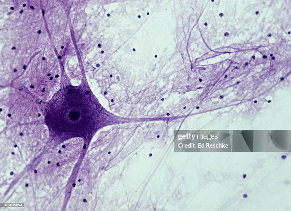 Motor neuron; Spinal Cord, 50X at 35mm. Shows: cell body, nucleus, dendrites (numerous processes attached to cell body), axon (single, long, nerve fiber), and neuroglial cells (dark spots).