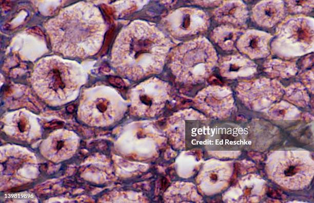 myelinated nerve fibers; cross section of a nerve, 400x at 35mm. shows: nerve fiber (dark), myelin sheath (white), and endoneurium (blue, connective tissue. masson stain. - sensory nerve fibers stock pictures, royalty-free photos & images
