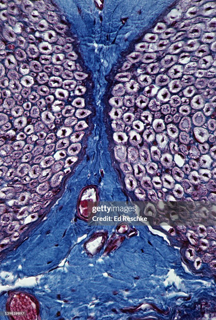 Nerve; cross section with myelinated fibers, 100X at 35mm. Shows: myelinated nerve fibers (nerve fibers dark, myelin sheath white), 2 fasicles (bundles of nerve fibers), perineurium (connective tissue, blue), and endoneurium (blue).