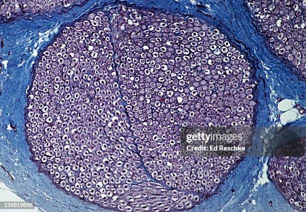 nerve; cross section, myelinated nerve fibers (nerve fibers are dark, surrounded by white myelin sheath), 50x at 35mm. shows a single fasciculus (bundle of nerve fibers), perineurium (blue connective tissue), and endoneurium (blue). - endoneurium stock pictures, royalty-free photos & images