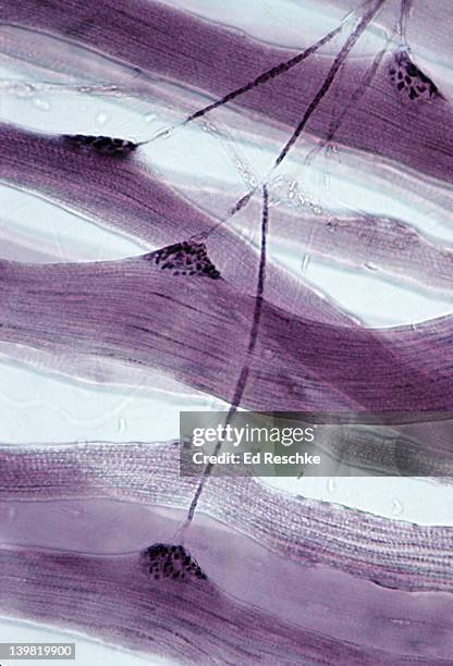 neuromuscular junctions. 100x at 35mm. shows: neuromuscular junctions (motor end plates), motor neuron axon (nerve fiber), and skeletal muscle fibers (cells). - neuromuscular junction stock pictures, royalty-free photos & images