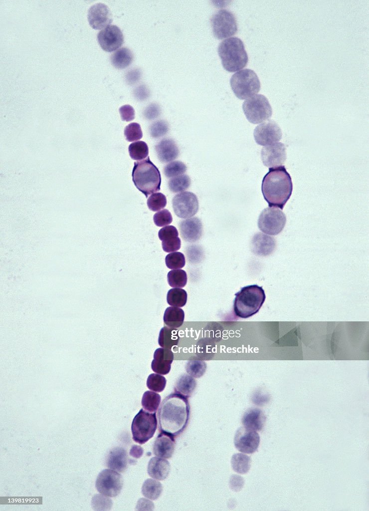 Anabaena; a filamentous cyanobacterium, photosynthetic, 250X at 35mm. Large oval cells are heterocysts, nitrogen fixation takes place in the heterocysts. Formerly known as blue-green algae. Prokaryotic cells, gram negative.