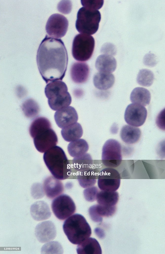 Anabaena; a filamentous cyanobacterium, photosynthetic, 500X at 35mm. Large oval cell is a heterocyst, nitrogen fixation takes place here. Prokaryotic cells, gram negative.