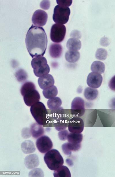 anabaena; a filamentous cyanobacterium, photosynthetic, 500x at 35mm. large oval cell is a heterocyst, nitrogen fixation takes place here. prokaryotic cells, gram negative. - nitrogen fixation stock pictures, royalty-free photos & images