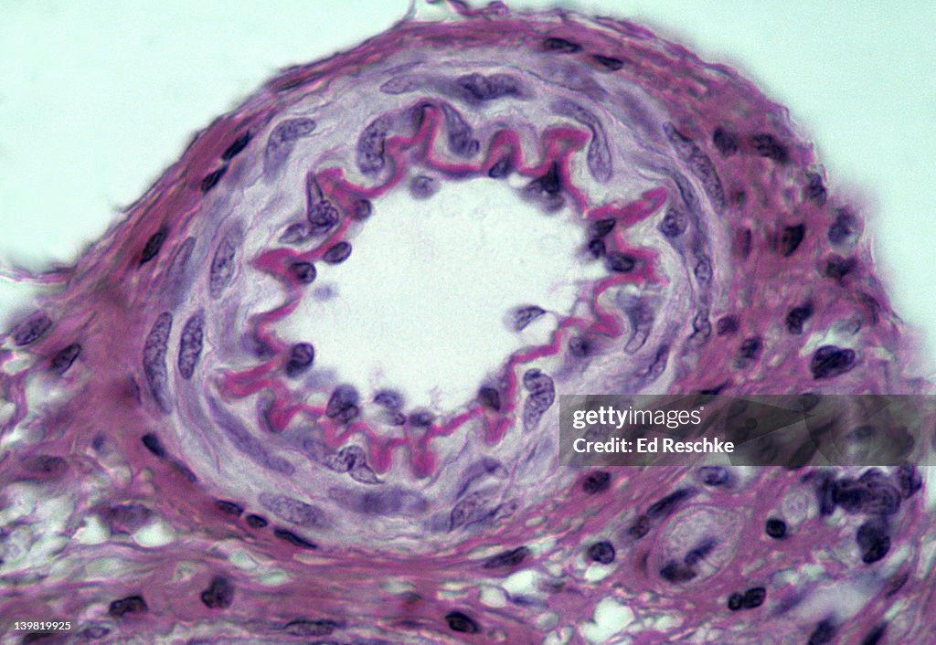 Arteriole (small artery), cross section, 250X at 35mm. Shows: tunica intima (endothelium & internal elastic membrane), tunica media (smooth muscle) & tunica adventitia (connective tissue). Arterioles play major role in regulation of blood pressure v