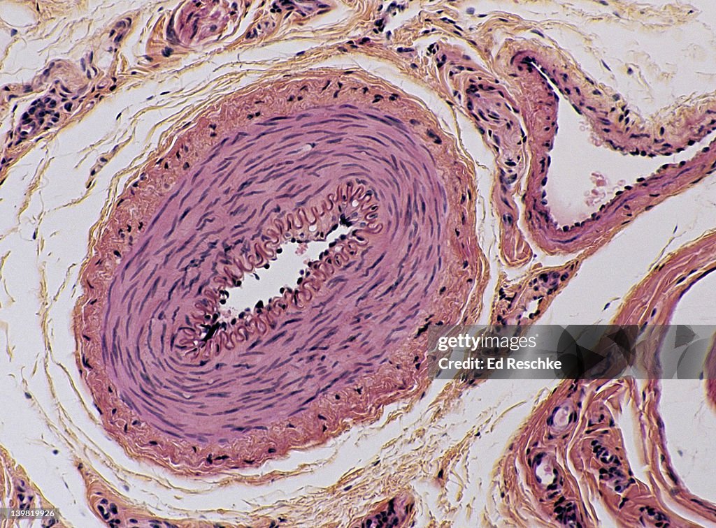 Artery (center) & vein (upper right), Cross section, 50X at 35mm. Shows 3 vascular layers or tunics in the artery: tunica intima (with the internal elastic membrane & endothelium), tunica media (smooth muscle), and the tunica adventitia (mostly conn