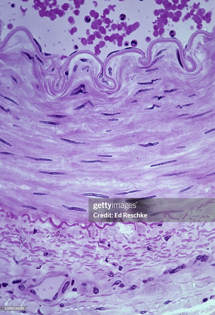 Artery wall; Tunica Intima, Tunica Media, Tunica Adventitia. Cross section, 100X at 35mm. The Tunica Intima shows the endothelium & internal elastic membrane, the Tunica Media shows smooth muscle tissue, & the tunica adventitia has an abundance of c