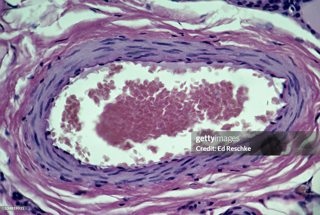 Artery, cross section, 100X at 35mm. The tunica intima shows the endothelium and some of the internal elastic membrane. Smooth muscle is in the tunica media. The tunica adventitia is mostly composed of connective tissue.