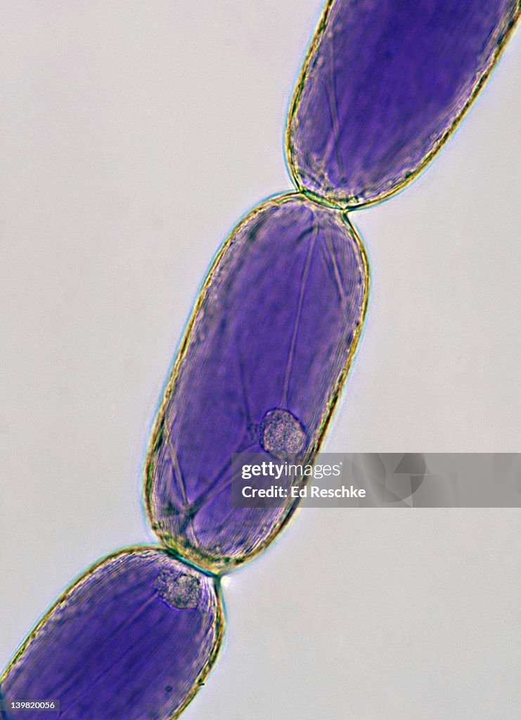 Plant cell stucture. Parenchyma tissue, Spiderwort (Tradescantia virginiana) 100X at 35mm. Shows: cell wall, nucleus, cytoplasm & large pigmented vacuole (anthocyanin pigment). Stamen hair of Spiderwort, great subject to show cytoplasmic streaming.