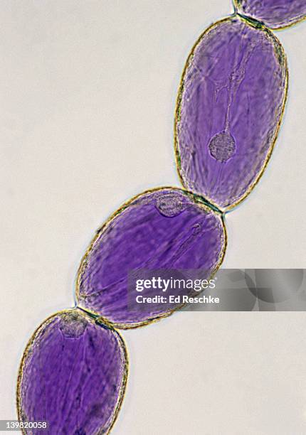 plant cell stucture. parenchyma tissue, spiderwort (tradescantia virginiana) 100x at 35mm. shows: cell wall, nucleus, cytoplasm & large pigmented vacuole (anthocyanin pigment). stamen hair of spiderwort, great subject to show cytoplasmic streaming. - vacuola fotografías e imágenes de stock