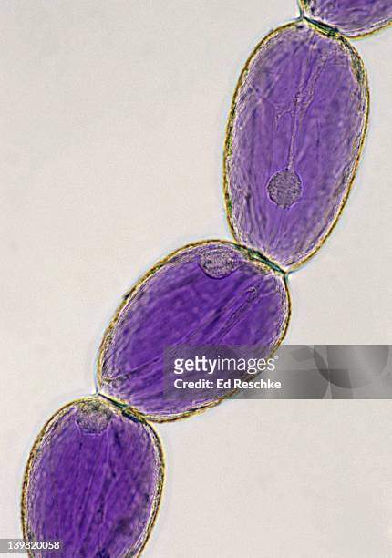 plant cell stucture. parenchyma tissue, spiderwort (tradescantia virginiana) 100x at 35mm. shows: cell wall, nucleus, cytoplasm & large pigmented vacuole (anthocyanin pigment). stamen hair of spiderwort, great subject to show cytoplasmic streaming. - vacuole stock pictures, royalty-free photos & images