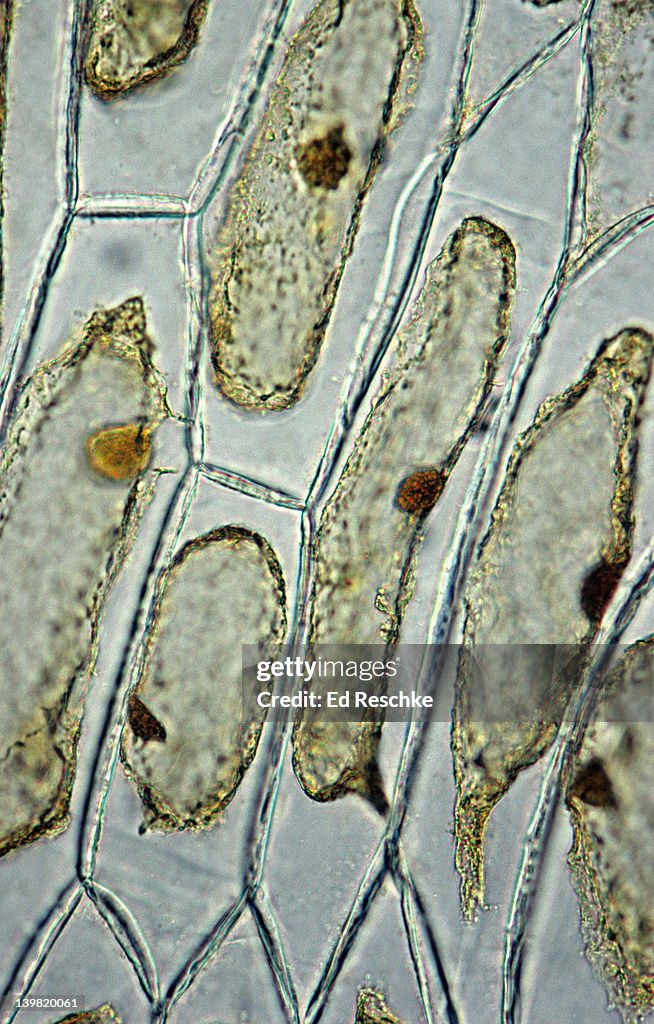 Plasmolysis. Onion Cells, Epidermis, Hypertonic solution. Onion cells were exposed to a hypertonic solution, & the protoplast lost water, shrunk & separated from cell wall. Shows: cell wall, nucleus, cytoplasm & cell membrane. Iodine stain.