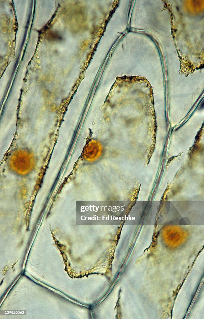 Plasmolysis. Onion Cells, Epidermis. 100x at 35mm. Onion cells were exposed to a hypertonic solution, & the protoplast lost water, shrunk & separated from cell wall. Shows: cell wall, nucleus, cytoplasm & cell membrane. Iodine stain.