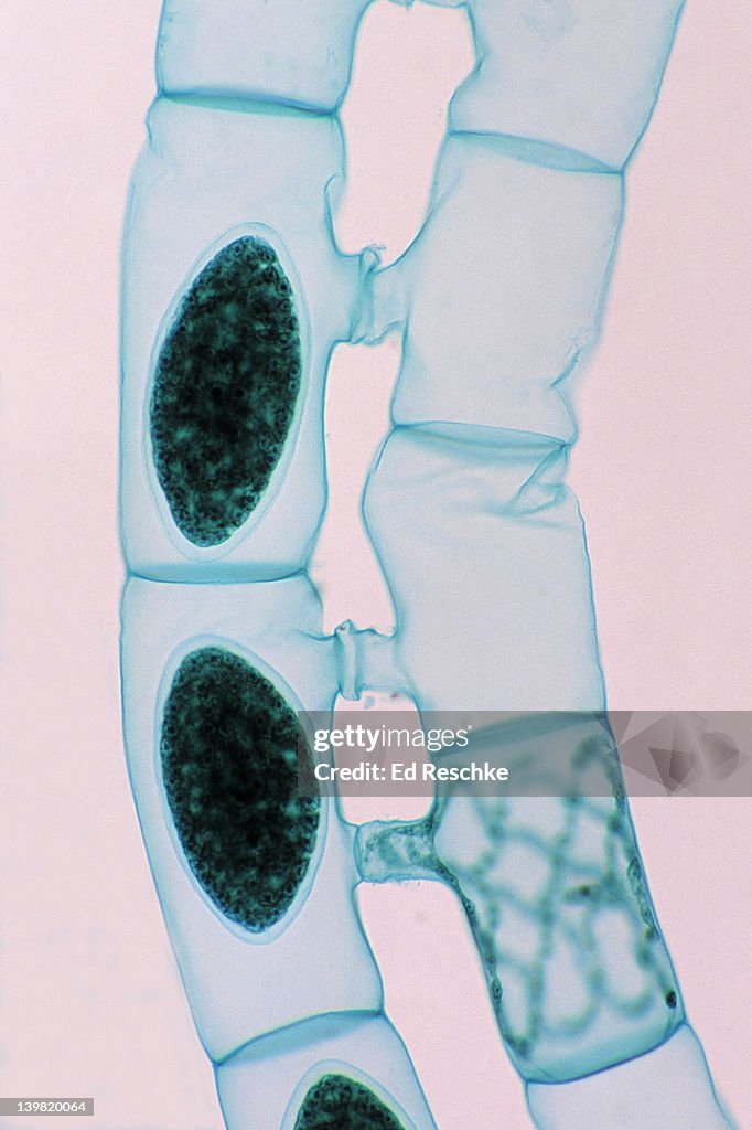 Spirogyra. Conjugation, Sexual Reproduction. 50X at 35mm. Shows: conjugation tubes, moving gamete and zygotes (dark oval structures). Filaments must be of two different mating types.