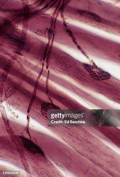 neuromuscular junctions. 100x at 35mm. shows: neuromuscular junctions (motor end plates), motor neuron axon (nerve fiber), and skeletal muscle fibers or cells (striated). - motor neuron stock-fotos und bilder