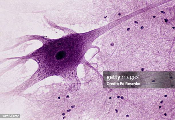 neuron (motor), spinal cord, 50x at 35mm. shows: cell body, nucleus, dendrites (several), axon (single, long nerve fiber), and neuroglial cells (black spots). - spinal neuron imagens e fotografias de stock