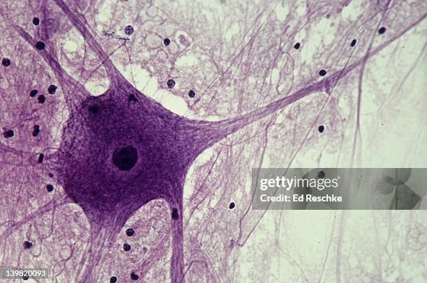 neuron (motor), spinal cord, 100x at 35mm. shows: cell body, nucleus, dendrites (several), axon (single, long nerve fiber), and neuroglial cells (black spots). - motor neuron stock-fotos und bilder