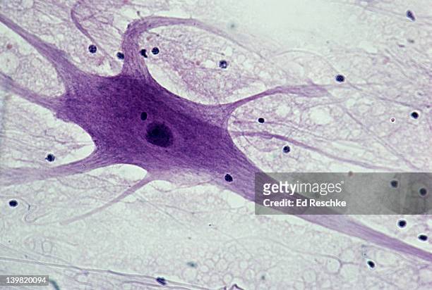 neuron (motor), spinal cord, 50x at 35mm. shows: cell body, nucleus, dendrites (several), axon (single, long nerve fiber), and neuroglial cells (black spots). - motor neuron stock-fotos und bilder