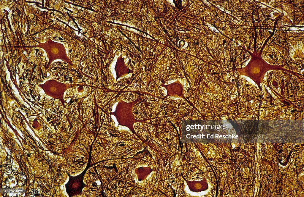 Neurons; gray matter, spinal cord, 50X at 35mm. Shows: cell bodies, nuclei, and unmyelinated nerve fibers (dendrites and axons). The entire image is gray matter within the spinal cord.