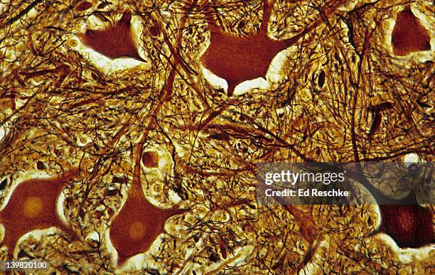 neurons; gray matter, spinal cord, 100x at 35mm. shows: cell bodies, nuclei, unmyelinated nerve fibers (dendrites and axons). the entire image is gray matter located inside the spinal cord. - hypothalamus stock pictures, royalty-free photos & images