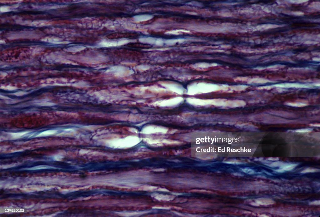 Nodes of ranvier; nerve, longitudinal section, 250X at 35mm. Shows: longitudinal sections of neurons, nodes of Ranvier (two constricted areas), nerve fiber (red), myelin (white)