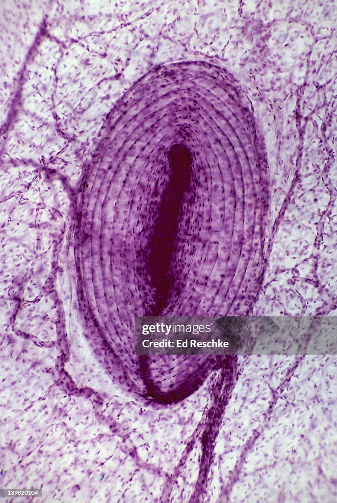 Pacinian corpuscle; sensory receptor, 25X at 35mm. Shows: the layered nature (like an onion) of the corpuscle, and a sensory nerve fiber (dendrite) attached. Detects deep pressure & vibrations; a pressoreceptor. Subcutaneous layer of the skin.