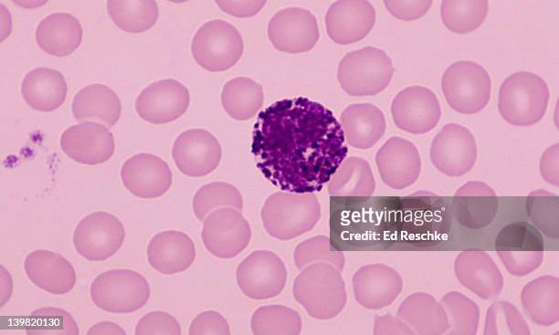 basophil; white blood cell (leukocyte), 400x at 35mm. human blood smear (wrights stain). shows large basophilic granules in the cytoplasm. they contain histamine & heparin. also shows red blood cells and platelets. - anticoagulant stock-fotos und bilder