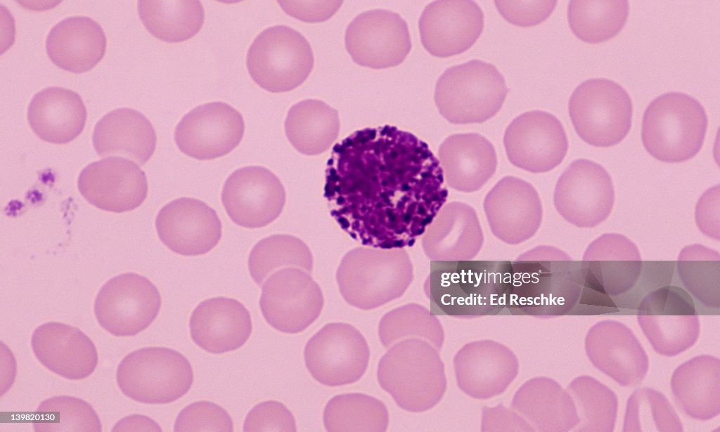 Basophil White Blood Cell Shows Large Basophilic Granules In The ...