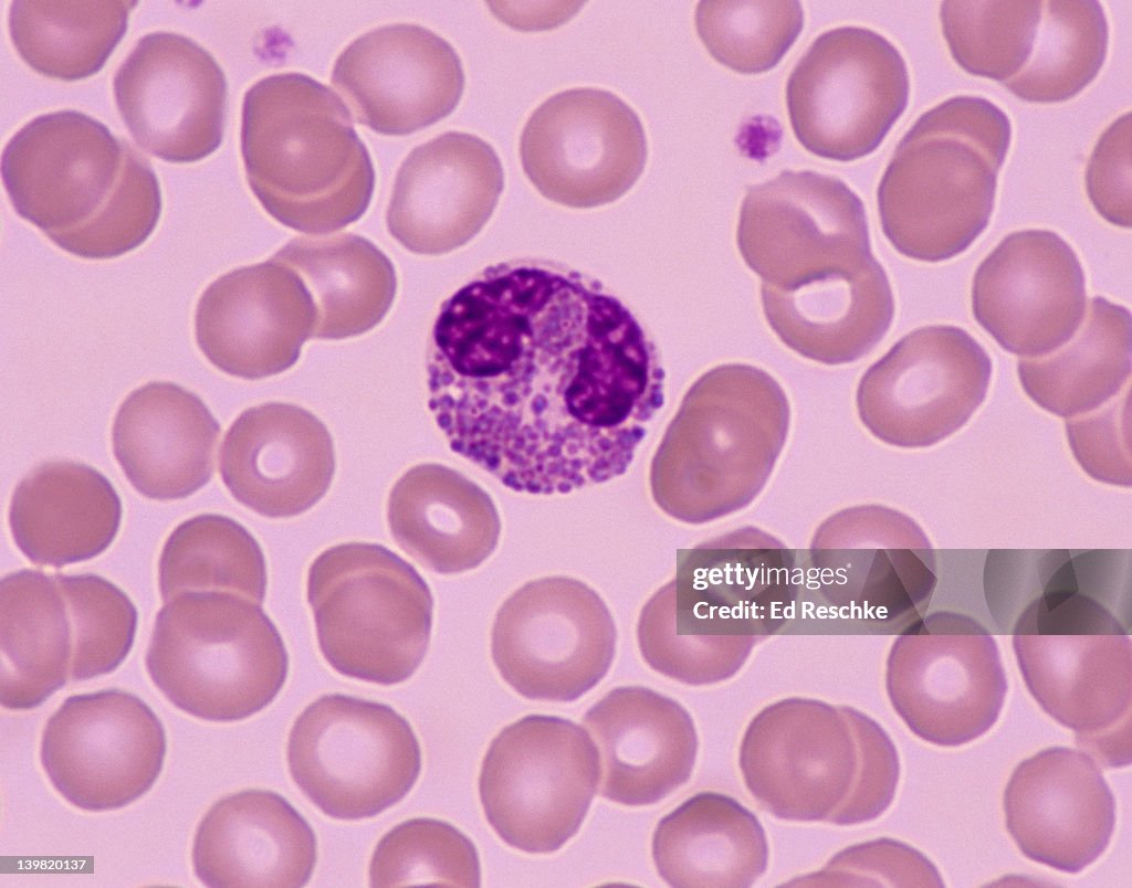 Eosinophil; white blood cell (leukocyte), 400X at 35mm. Human blood smear. Eosinophils have a bilobed nucleus, and large, reddish cytoplasmic granules. Increased numbers of eosinophils (eosinophilia) occur in allergies. 1-3% of the total # of white