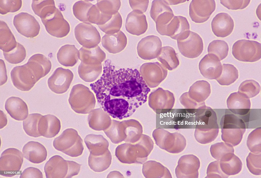 Eosinophil; white blood cell (leukocyte), 400X at 35mm. Human blood smear. Eosinophils have a bilobed nucleus & large reddish cytoplasmic granules. There are increased numbers (eosinophilia) in allergies. 1-3% of the total # of white blood cells. Al
