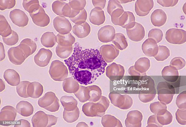 eosinophil; white blood cell (leukocyte), 400x at 35mm. human blood smear. eosinophils have a bilobed nucleus & large reddish cytoplasmic granules. there are increased numbers (eosinophilia) in allergies. 1-3% of the total # of white blood cells. al - citoplasma imagens e fotografias de stock