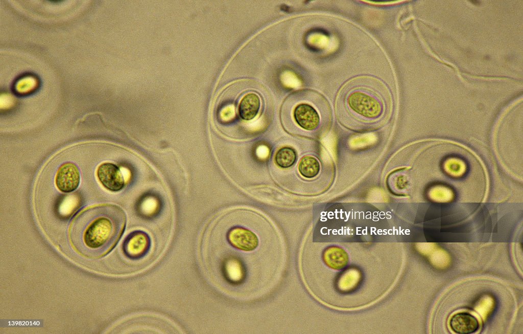 Gloeocapsa; a Cyanobacteria, Photosynthetic, gram negative, 100X at 35mm. Formerly known as blue-green algae. Prokaryotic cell. Cells enclosed in layers of gelatinous material.