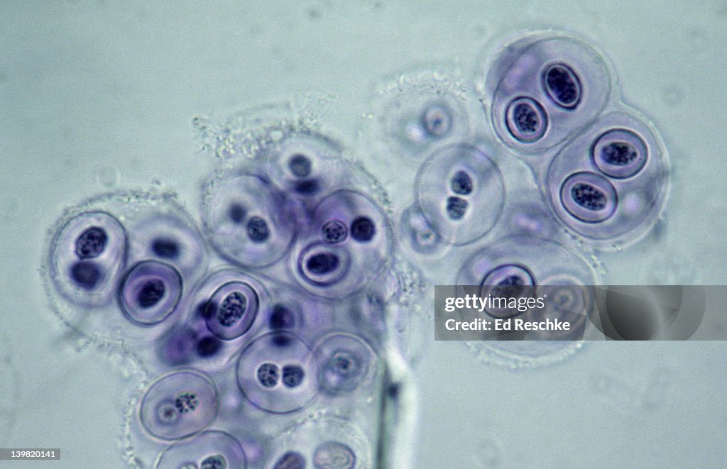 Gloeocapsa, a Cyanobacteria, Photosynthetic, gram negative, 250X at 35mm. Nitrogen fixing, unicellar. Cells enclosed in layers of gelatinous material. Formerly known as blue-green algae.