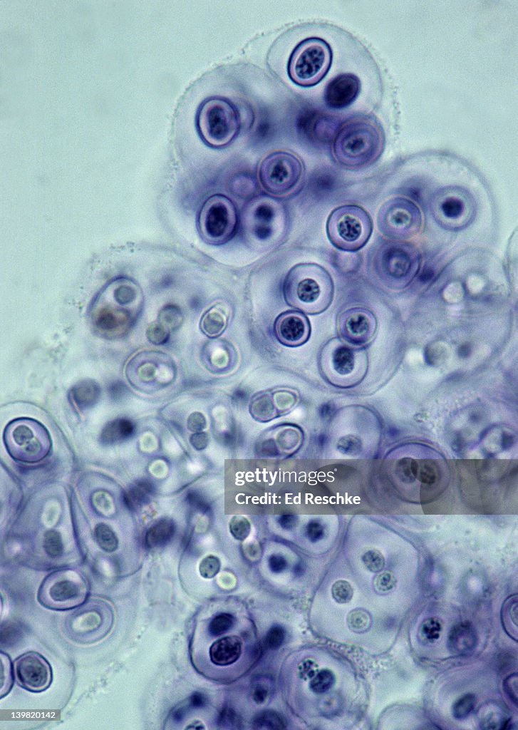 Gloeocapsa, a Cyanobacteria, Photosynthetic, gram negative, 100X at 35mm. Formerly known as blue-green algae. Prokaryotic cell. Cells enclosed in layers of gelatinous material.