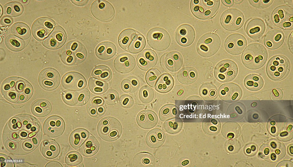 Gloeocapsa, a Cyanobacteria, Photosynthetic, gram-negative, 100X at 35mm. Formerly known as blue-green algae. Prokaryotic cell. Cells enclosed in layers of gelatinous material.