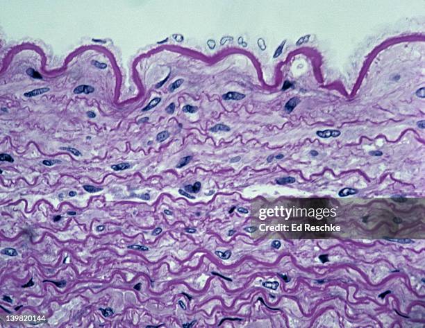 large artery wall (sectioned). elastic fibers, 100x at 35mm. shows extremely abundant elastic fibers (red, connective tissue), an internal elastic membrane, & endothelium (lining). large arteries near heart are subjected to high pressures & show hig - endothelial stock pictures, royalty-free photos & images