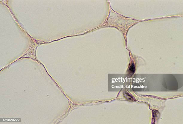 adipose tissue, fat cells, connective tissue, 250x at 35mm shows: fat cells (adipocytes), cytoplasm, nucleus, and fat droplet (large, clear spaces, once occupied by fat. specialized connective tissue. - adipose tissue stock pictures, royalty-free photos & images