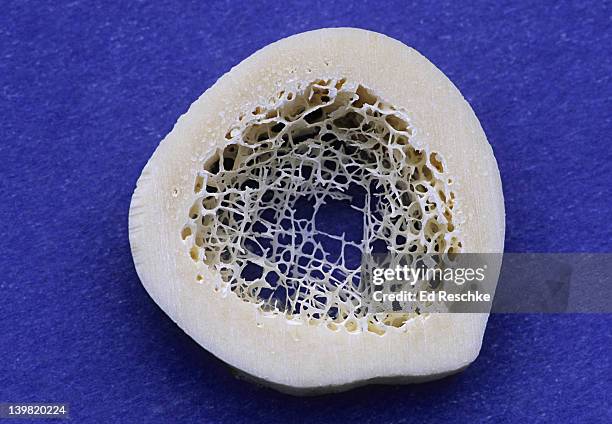 compact & spongy (cancellous) bone. cross section of a long bone. shows: compact bone, spongy (cancellous) bone, and marrow cavity.  - beenmerg bot stockfoto's en -beelden