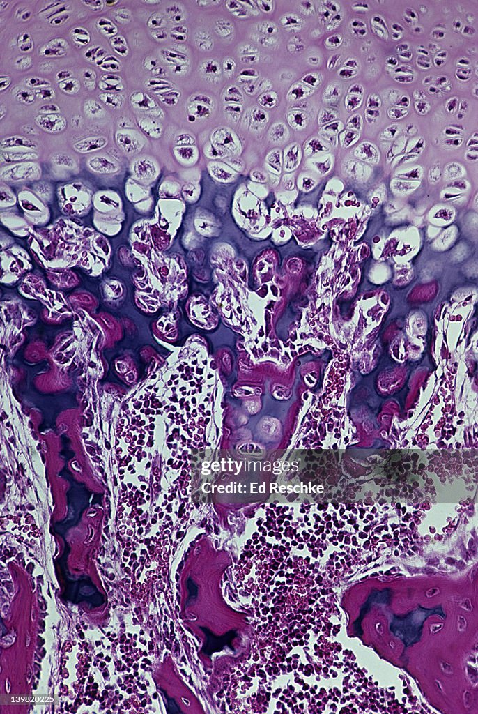 Developing bone. Endochondral ossification with epiphyseal disk, 50X at 35mm. Shows: epiphyseal disk, calcified cartilage(purple), osteoblasts, osteocytes, mesenchyme, and newly formed bone (red).