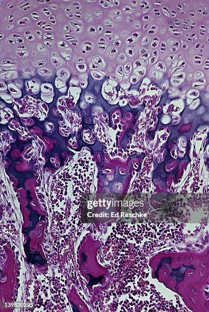 developing bone. endochondral ossification with epiphyseal disk, 50x at 35mm. shows: epiphyseal disk, calcified cartilage(purple), osteoblasts, osteocytes, mesenchyme, and newly formed bone (red). - osteocyte stock pictures, royalty-free photos & images