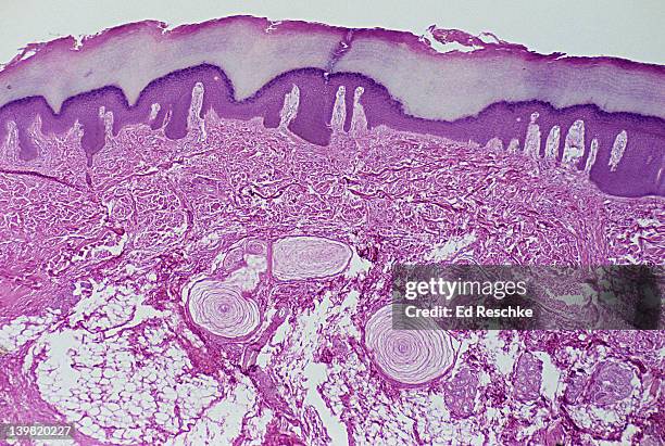 pacinian corpuscles; sensory receptors in skin (subcutaneous layer), 10x at 35mm. three pacinian corpuscles are seen in the subcutaneous layer of thick skin. these receptors have a layered nature. they detect deep pressure & vibrations - pacinian corpuscle stock pictures, royalty-free photos & images